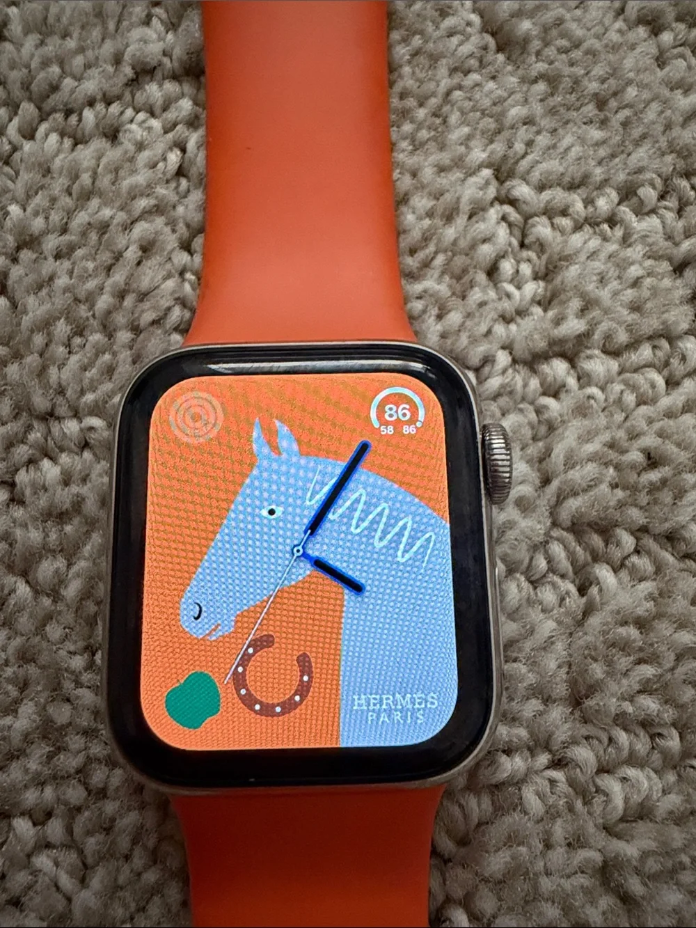 Hermes/Apple Watch